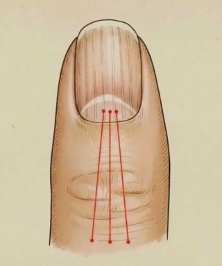 What to Eat to Reduce Nail Ridges: A Nutrition Guide for Healthier Nails