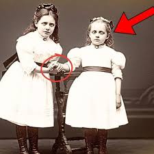 This 1895 Photo of a Girl Holding Her Sister’s Hand Seemed Normal — Until Restoration Revealed